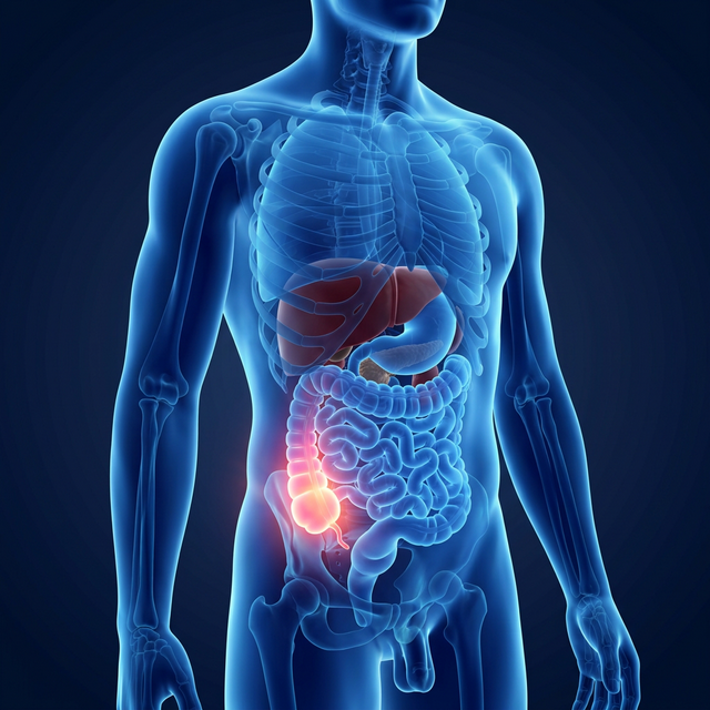 Understanding Appendicitis